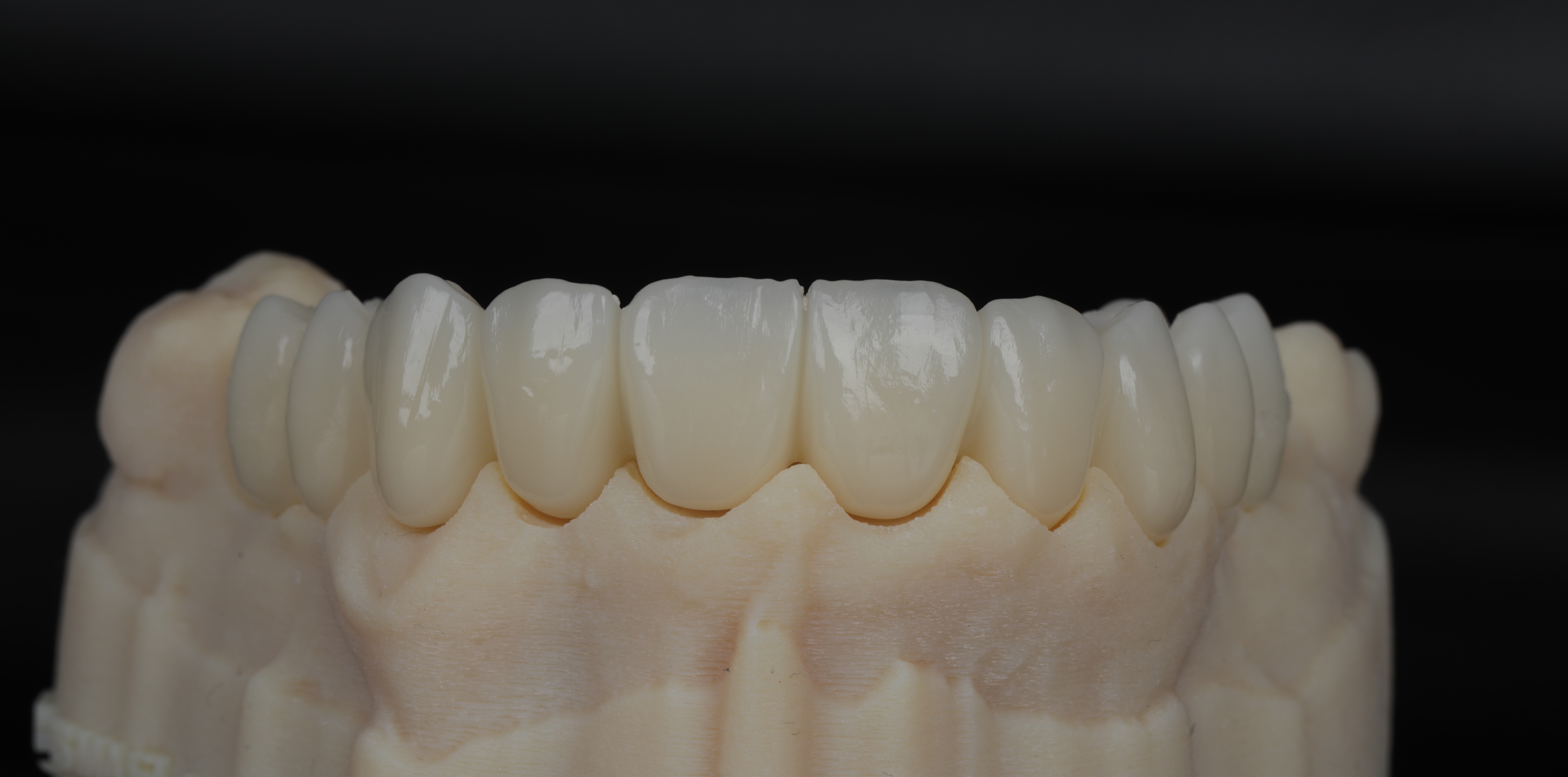 Design and use surgical guides