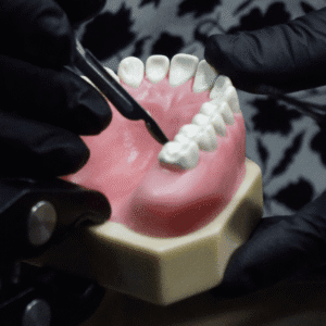Implant Mini-Residency