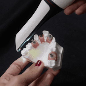 Socket Preservation & Bone Grafting